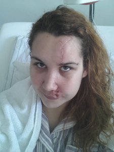 2014.02.24. - varratszedés után