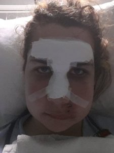 Este, a műtét után